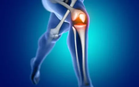 Especialista explica como funciona a Artroplastia de joelho e quadril